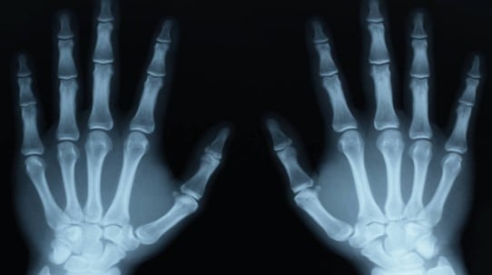 X-RAY IMAGES_accidental inventions