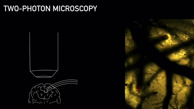 Elon Musk's Neuralink Exposed! All That You Need To Know About The Brain Implant Chip 2