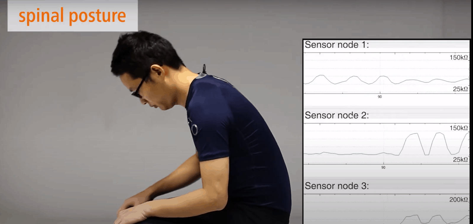 Spinal posture monitoring