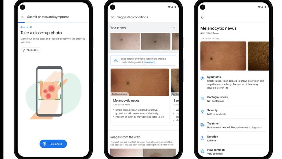Google New Dermatology Assist Tool Is Now A Big Concern For The Healthcare System